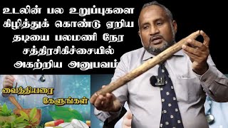 உடலின் பல உறுப்புகளை கிழித்துக்கொண்டு ஏறிய தடியை பலமணி நேர சத்திரசிகிச்சையில் அகற்றிய அனுபவம்