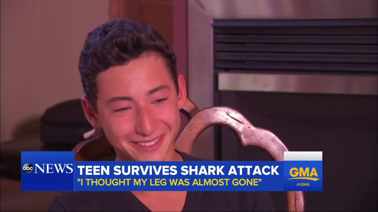 Shark Attack Survivor Gets Leg Rebuilt By Doctors - YouTube