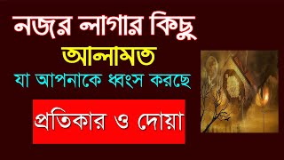 নজর লাগার ভয়ংকর কিছু আলামত | জীবন নষ্ট করে দেয় | নজর কাটার দোয়া ও আমল | nojor lagar dua