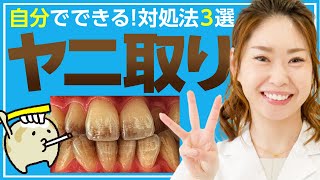 歯の【ヤニ取り】方法3選！自分でタバコのヤニを落としたい人必見