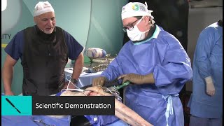 WST 2021 I Open Reduction and Internal Fixation in Distal Femur Fracture - Trailer