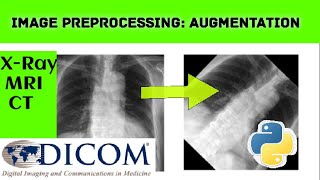 Image preprocessing: how to do augmentation python programming ITFO