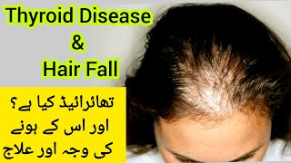 Thyroid Disease hota kiya hai | Thyroid Disease & Hair Fall |Thyroid Disease ka Ilaj | Dr Rida Ahmed