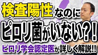 ピロリ菌が陽性と言われても慌てないで！本当にピロリ菌がいてるのか？