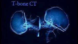 neuroradiology head and neck radiology  lecture