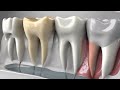 Navigating Root Canal Costs: Europe vs. Turkey - Is it cheaper to get a root canal in Turkey compa