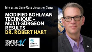 Modified Bohlman Technique: Multi-Surgeon Results - Robert Hart, M.D.