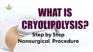 What is Cryolipolysis? Nonsurgical Live Procedure of Cryolipolysis Treatment \u0026 Facts (CoolSculpting)