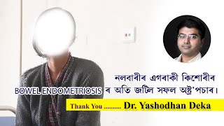 নলবাৰীৰ এগৰাকী কিশোৰীৰ BOWEL ENDOMETRIOSIS ৰ অতি জটিল সফল অস্ত্ৰোপচাৰ। Sarathi | Dr. Yashodhan Deka.