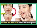 Mid Face Lift | Get rid of mid cheek lines, remove midface wrinkles with Face exercise & massage