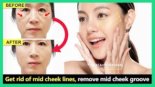 Mid Face Lift | Get rid of mid cheek lines, remove midface wrinkles with Face exercise \u0026 massage