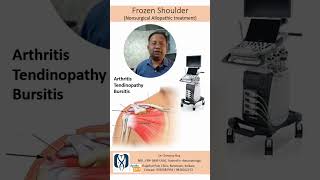 Frozen shoulder, কাঁধের ব্যথা (ফ্রোজেন সোল্ডার)