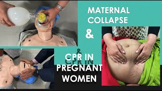 Maternal Collapse and CPR in Pregnant women; Perimortem Caesarean section