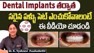 Types Of Dental Implant Materials In Telugu || Comparison Of Prosthetic Teeth || Eledent Hospitals