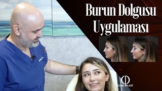 Burun Dolgusu Nasıl Yapılır? (Uygulamalı Anlatım) - CLINICPLAST