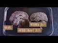 neuroanatomy s3 e4 pain neuroanatomy ubcmedicine