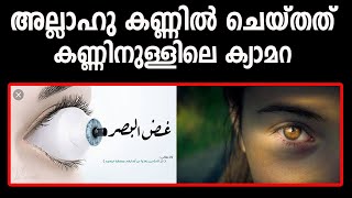 കണ്ണിലെ ക്യാമറ അല്ലാഹു കണ്ണിൽ ചെയ്തത് കണ്ടോ EYE MARHABA MEDIA