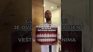 Da li vam ove veštačke desni deluju prirodno? #dentist #allon6dentalimplants