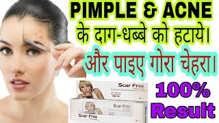 Scar Free Cream full Review | for Acne Scars \u0026 Marks | Fairness ?😨