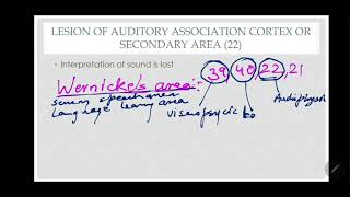 Wernicke's Area Simplified | Brodmann's Area 21, 22, 39, 40 | Expressive Aphasia | Dr. Azmi Mohsin