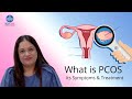 What is PCOS/PCOD, Its symptoms & treatment