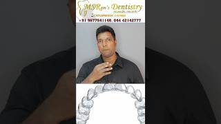 உங்கள் எத்து பல்லை Digital முறையில் சீக்கிரமாக வரிசை படுத்த Invisalign clear aligners#shorts #viral