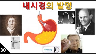 발명의 탄생 #30: 내시경의 발명(endoscope)