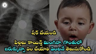 పిల్లలు కాయిన్స్ మింగినా, గొంతులో ఇరుక్కున్నా ఏం చేయాలి వెంటనే తెలుసుకోండి | kids Swallowed Coins