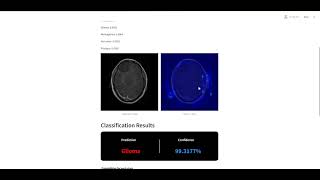 Brain tumor Machine learning Classification project with Streamlit UI