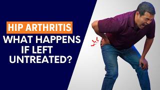 What Will Happen if Hip Arthritis is Not Treated?