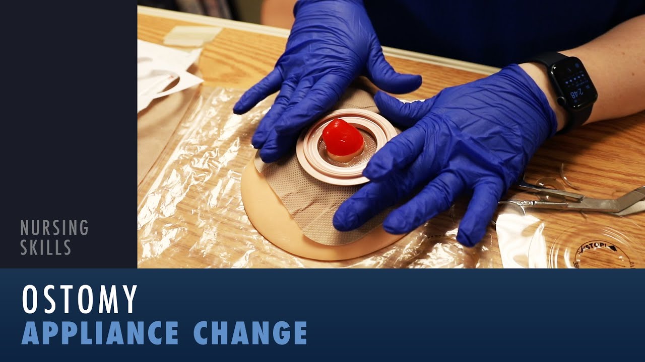 Nursing Skills: Ostomy Appliance Change - YouTube