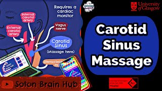 Carotid sinus massage Rapid Review