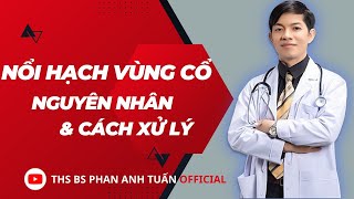 NGUYÊN NHÂN VÀ CÁCH XỬ LÝ KHI NỔI HẠCH VÙNG 2 BÊN CỔ | THS BS PHAN ANH TUẤN OFFICIAL