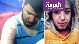 تفاعلكم | محتجو العراق يسقطون ببنادق صيد! صور مؤلمة