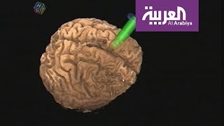 خبرٌ سار لكبار السن، قليلٌ من الرياضة كالمشي .. يقي من أمراضِ  الشيخوخة