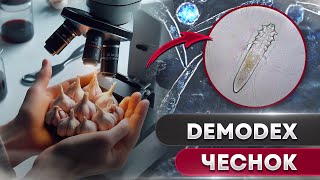 Чеснок против клеща | Угревая Железница Demodex