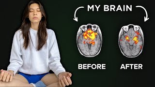 How 6 Weeks Of Meditation Can Literally Change The Brain