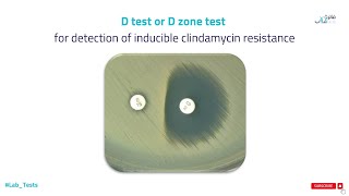 D test or D zone test for detection Clindamycin resistance