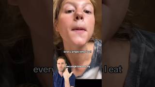 Does your nose RUN when you EAT??