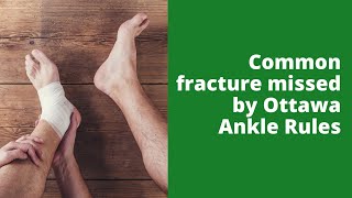 Common fracture missed by Ottawa Ankle Rules