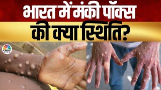 What Is Monkey Pox? |- मौजूदा आउटब्रेक किन देशों तक पहुंचा?- मंकी पॉक्स वायरस से कैसे रहें सुरक्षित?