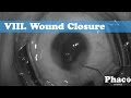 Phaco Annotated | VIII. Wound Closure