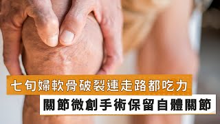 【鍾承翰醫師】七旬婦藉關節微創手術　自體軟骨修復免人工關節免拐杖｜健康醫療網