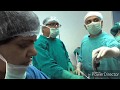 Laparoscopic Cholecystectomy