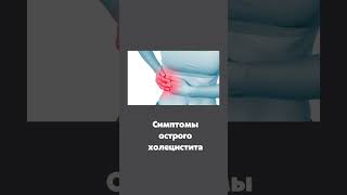 Симптомы острого холецистита | 5 основных симптомов, которые должен знать каждый врач.