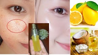 How to make serum vitamin C natural របៀបធ្វើសរ៉ូមវិតាមីនcលាបមុខ អោយសរលោងតឹងណែនក្មេងជាងវ័យ