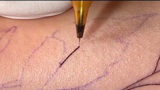Fine Line Tattoo | Single Needle