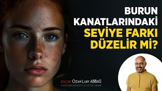 Burun Kanatlarındaki Seviye Farkı Düzelir mi? | Doç. Dr. Ozan Luay ABBAS