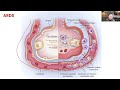 day 16 90 days nclex training by stancoast acute respiratory distress syndrome nclex review