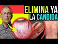 QUITA LA PELIGROSA CANDIDA De Manera NATURAL - Oswaldo Restrepo RSC